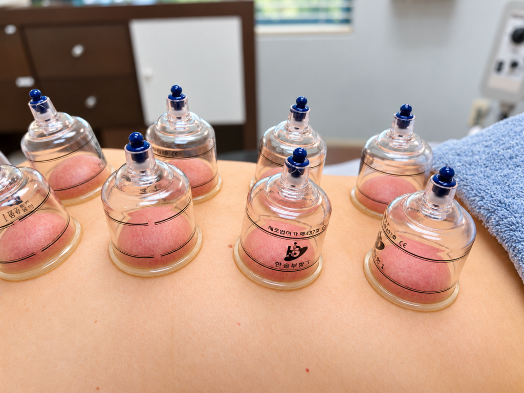 Close-up of clear cupping cups showing skin gently lifted by suction