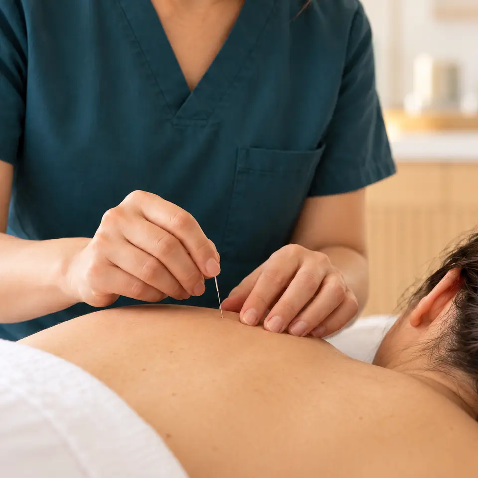 Gentle acupuncture treatment performed at Blissful Wellness